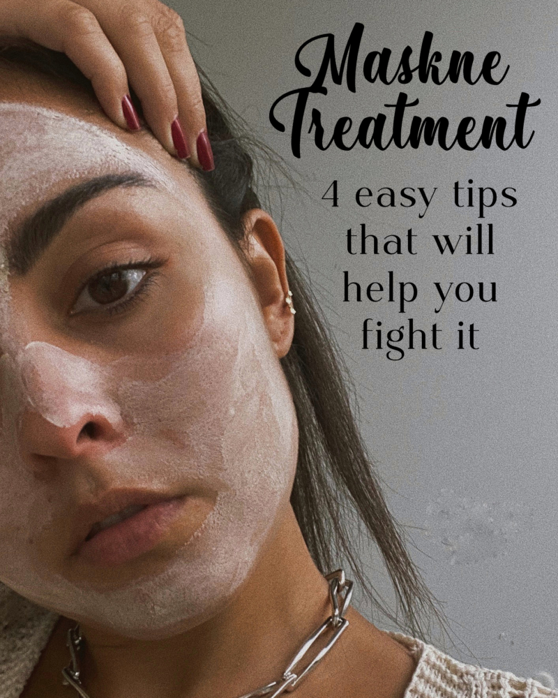 Maskne Treatment: 4 Easy Tips That Will Help You